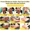 Bee Venom Corn and Callus Removal Cream