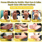 Bee Venom Corn and Callus Removal Cream