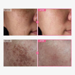 Dark Spot Correcting Cream