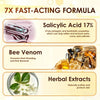 Bee Venom Corn and Callus Removal Cream